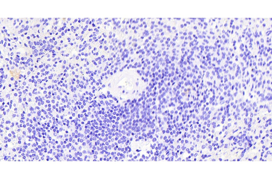 Immunohistochemistry - Anti-Thrombospondin Antibody (A84637) - Antibodies.com