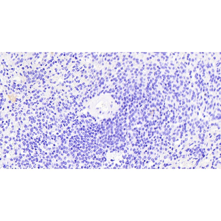 Immunohistochemistry - Anti-Thrombospondin Antibody (A84637) - Antibodies.com