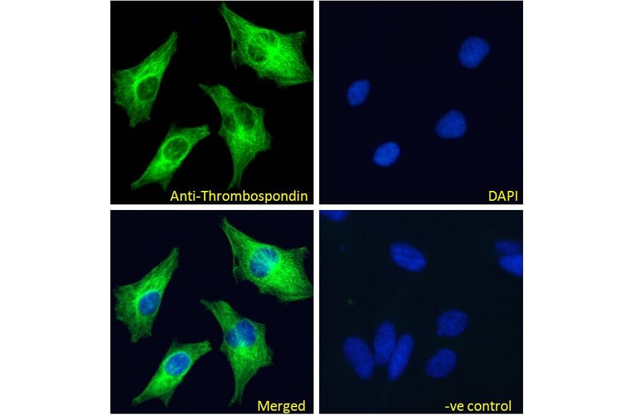Immunofluorescence - Anti-Thrombospondin Antibody (A84637) - Antibodies.com