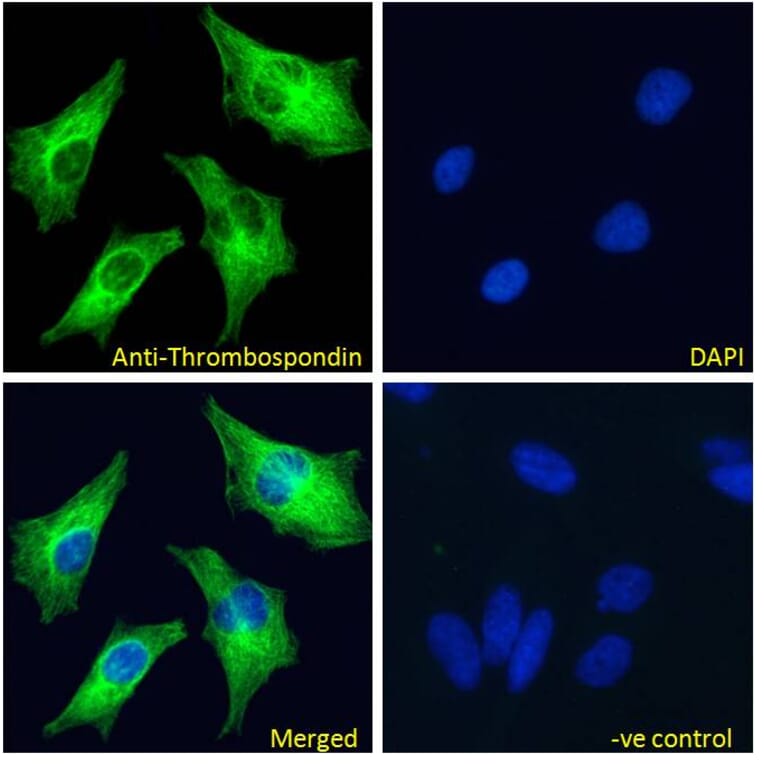 Immunofluorescence - Anti-Thrombospondin Antibody (A84637) - Antibodies.com