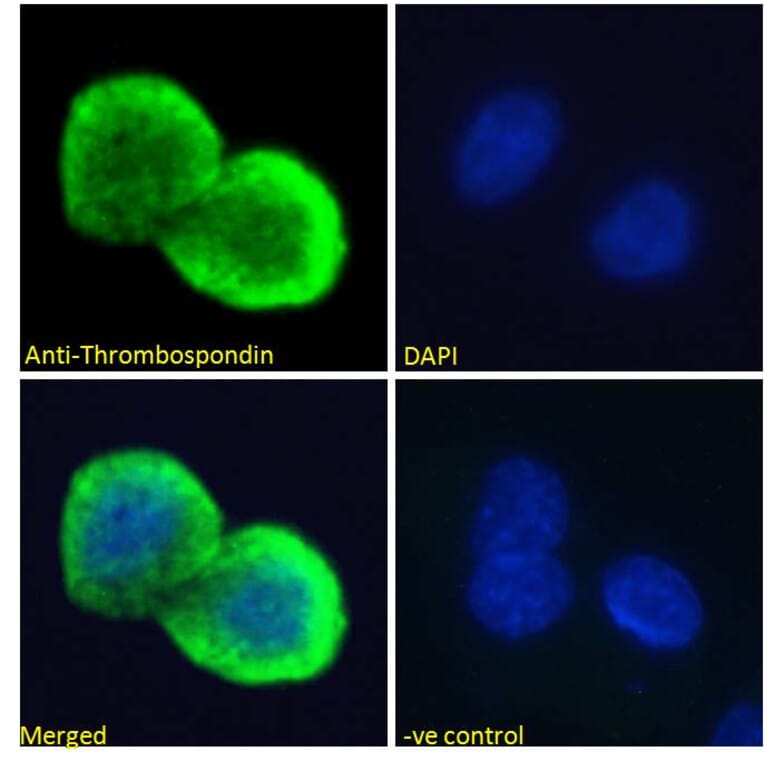 Immunofluorescence - Anti-Thrombospondin Antibody (A84637) - Antibodies.com