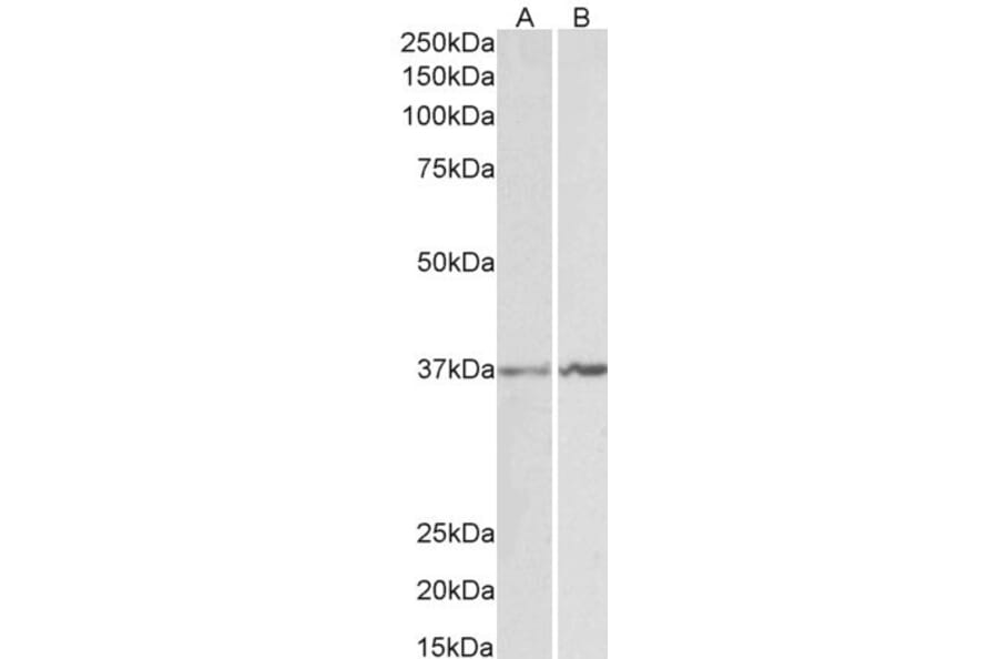 Western Blot - Anti-Annexin A1/ANXA1 Antibody (A84638) - Antibodies.com