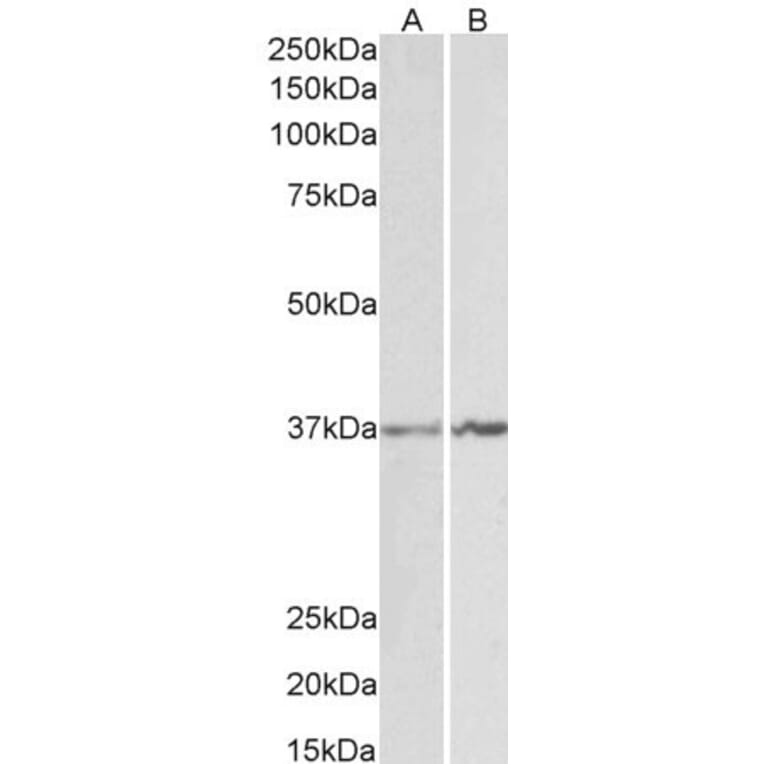 Western Blot - Anti-Annexin A1/ANXA1 Antibody (A84638) - Antibodies.com