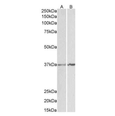 Western Blot - Anti-ANXA1 Antibody (A84638) - Antibodies.com