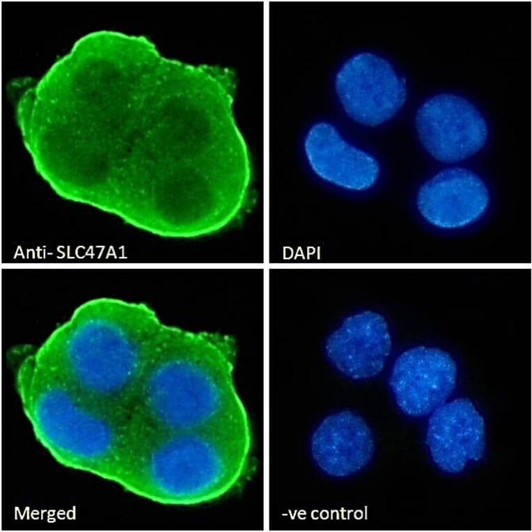 Immunofluorescence - Anti-MATE-1 Antibody (A84639) - Antibodies.com