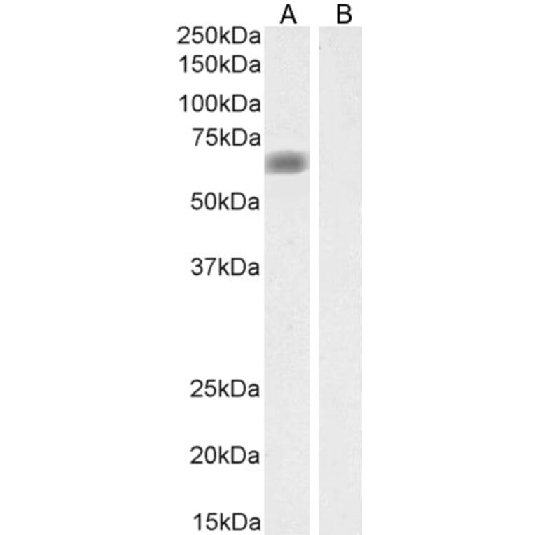 Western Blot - Anti-MATE-1 Antibody (A84639) - Antibodies.com