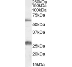Western Blot - Anti-SLC47A1 Antibody (A84639) - Antibodies.com