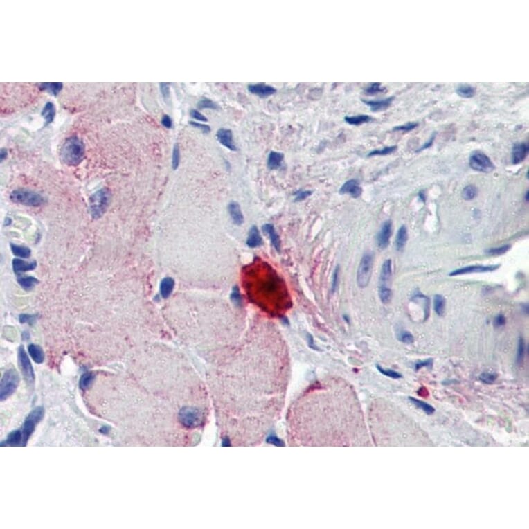 AntiMCPT4 Antibody (A84640)