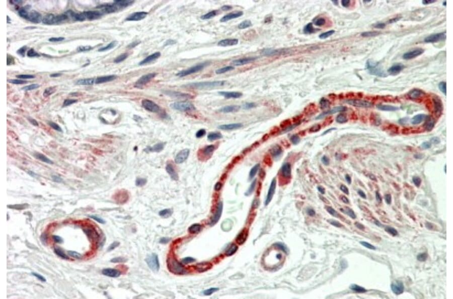 Immunohistochemistry - Anti-THBS3 Antibody (A84641) - Antibodies.com