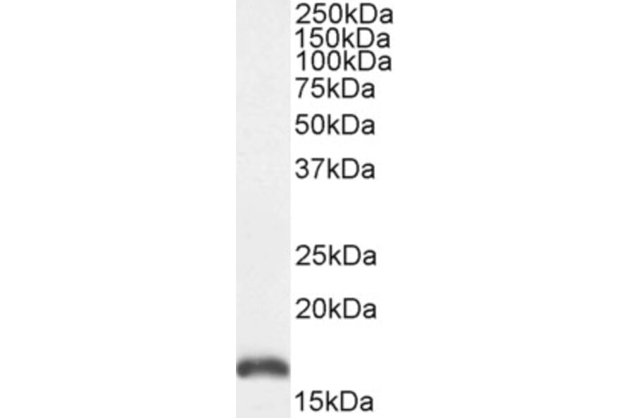 Western Blot - Anti-PBR Antibody (A84643) - Antibodies.com