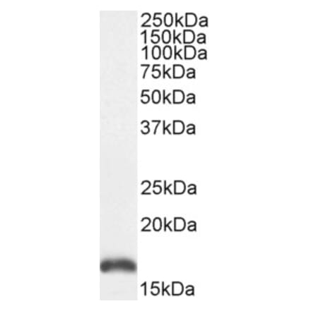 Western Blot - Anti-PBR Antibody (A84643) - Antibodies.com