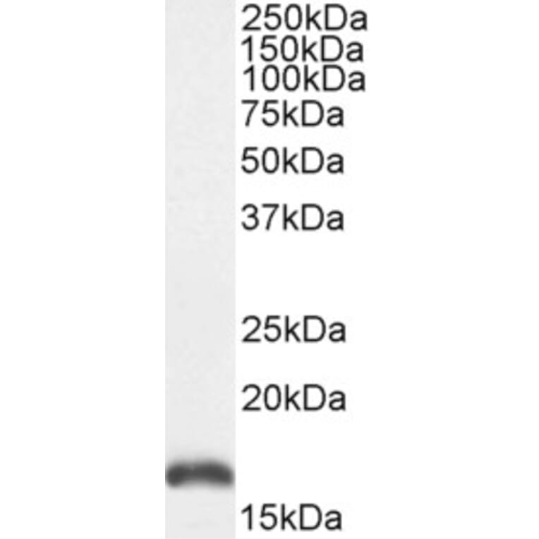 Western Blot - Anti-PBR Antibody (A84643) - Antibodies.com