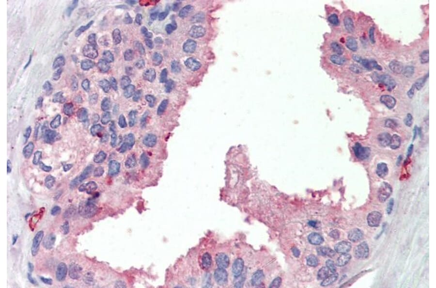 Immunohistochemistry - Anti-SRD5A1 Antibody (A84645) - Antibodies.com
