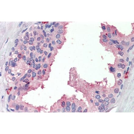 Immunohistochemistry - Anti-SRD5A1 Antibody (A84645) - Antibodies.com