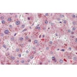 Immunohistochemistry - Anti-SRD5A1 Antibody (A84645) - Antibodies.com