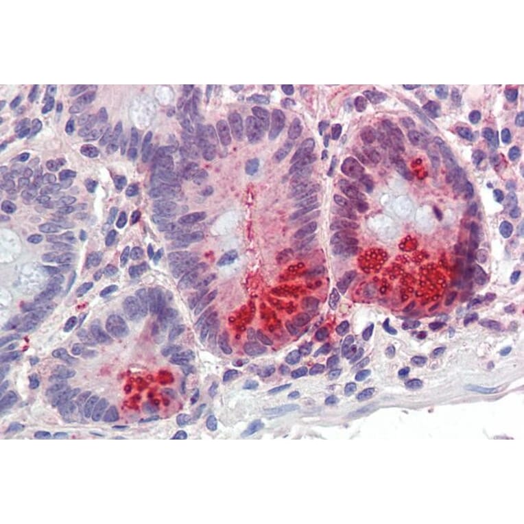 Immunohistochemistry - Anti-SRD5A1 Antibody (A84645) - Antibodies.com