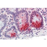 Immunohistochemistry - Anti-SRD5A1 Antibody (A84645) - Antibodies.com