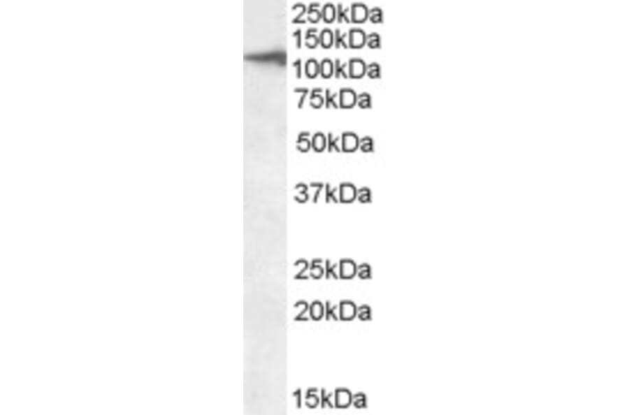 Western Blot - Anti-CLEC16A Antibody (A84646) - Antibodies.com