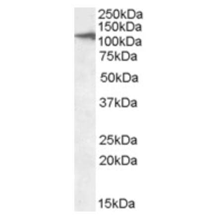 Western Blot - Anti-CLEC16A Antibody (A84646) - Antibodies.com