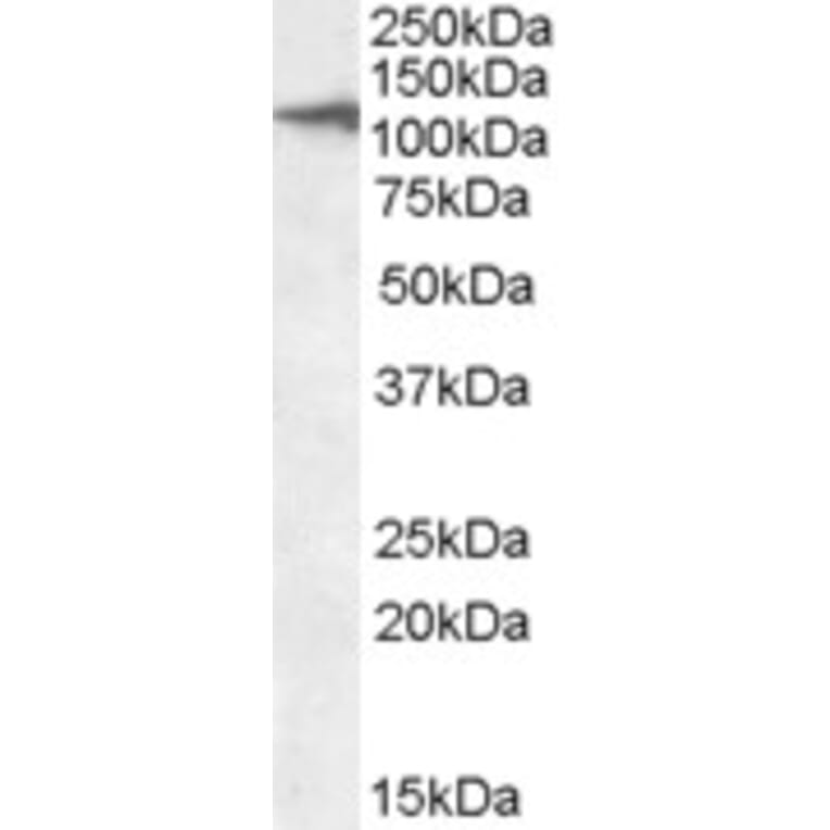 Western Blot - Anti-CLEC16A Antibody (A84646) - Antibodies.com