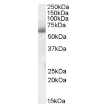 Western Blot - Anti-SH2D3A Antibody (A84648) - Antibodies.com