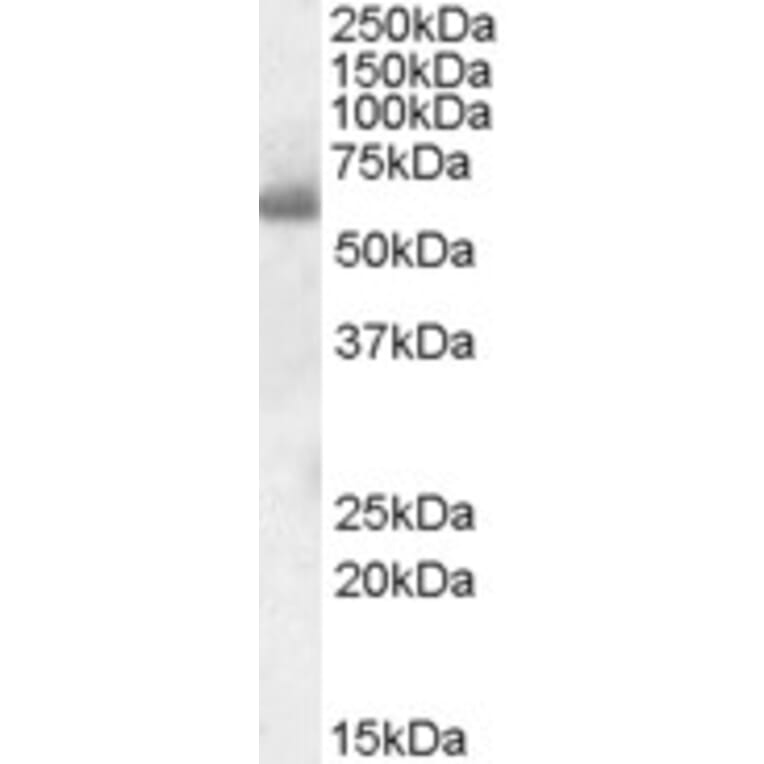 Western Blot - Anti-SH2D3A Antibody (A84648) - Antibodies.com