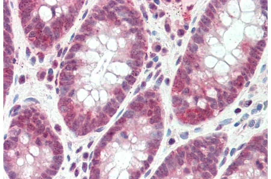 Immunohistochemistry - Anti-SH2D3A Antibody (A84648) - Antibodies.com