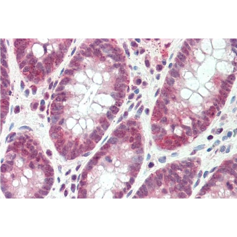 Immunohistochemistry - Anti-SH2D3A Antibody (A84648) - Antibodies.com