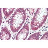Immunohistochemistry - Anti-SH2D3A Antibody (A84648) - Antibodies.com