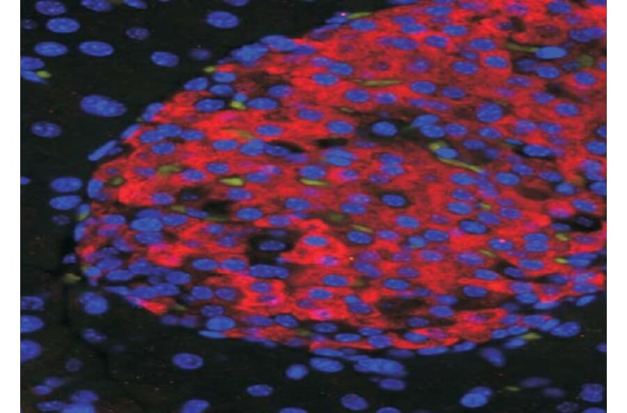 Immunofluorescence - Anti-UNC5C Antibody (A84649) - Antibodies.com