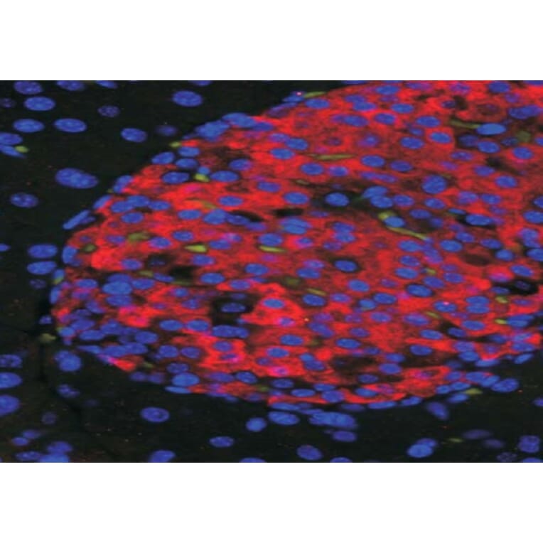 Immunofluorescence - Anti-UNC5C Antibody (A84649) - Antibodies.com