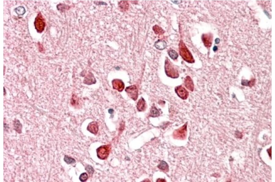 Immunohistochemistry - Anti-UNC5C Antibody (A84649) - Antibodies.com