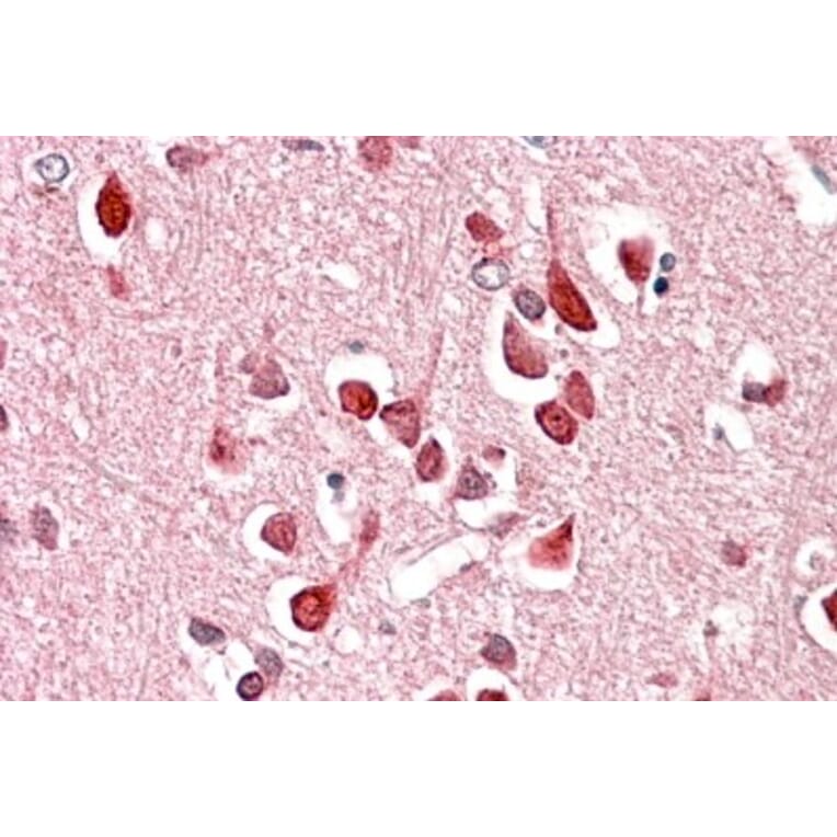 Immunohistochemistry - Anti-UNC5C Antibody (A84649) - Antibodies.com