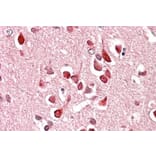 Immunohistochemistry - Anti-UNC5C Antibody (A84649) - Antibodies.com