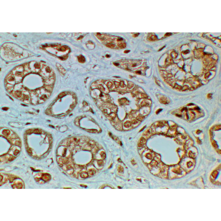 Immunohistochemistry - Anti-Frizzled 4 Antibody (A84651) - Antibodies.com