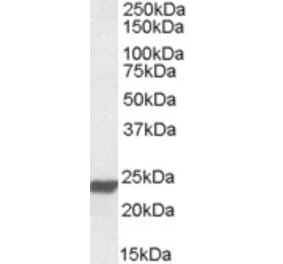 Western Blot - Anti-HMGB3 Antibody (A84653) - Antibodies.com