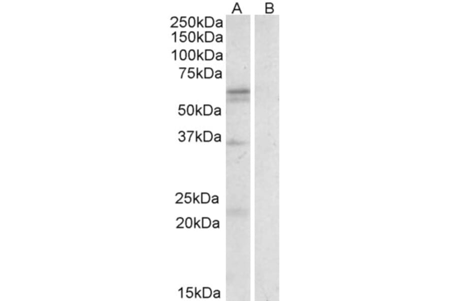 Western Blot - Anti-SLC7A5/LAT1 Antibody (A84654) - Antibodies.com