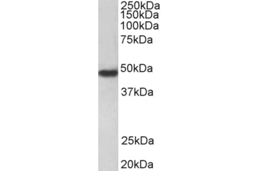 Western Blot - Anti-PAR1/Thrombin Receptor Antibody (A84655) - Antibodies.com