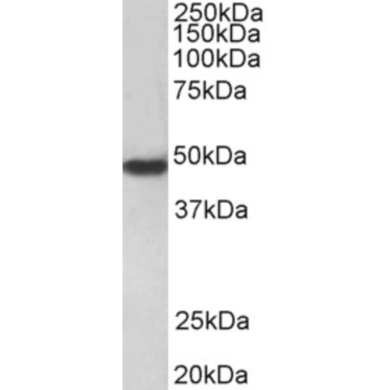 Western Blot - Anti-PAR1/Thrombin Receptor Antibody (A84655) - Antibodies.com
