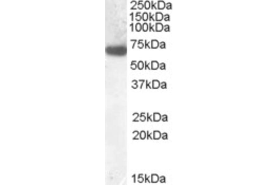 Western Blot - Anti-GCKR Antibody (A84656) - Antibodies.com
