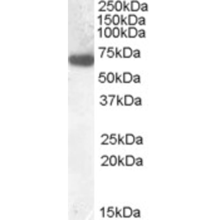 Western Blot - Anti-GCKR Antibody (A84656) - Antibodies.com