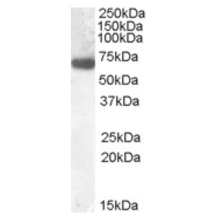 Western Blot - Anti-GCKR Antibody (A84656) - Antibodies.com