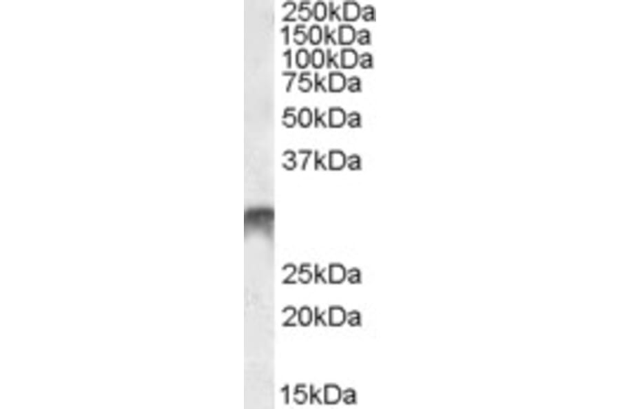 Western Blot - Anti-Dlx5 Antibody (A84658) - Antibodies.com