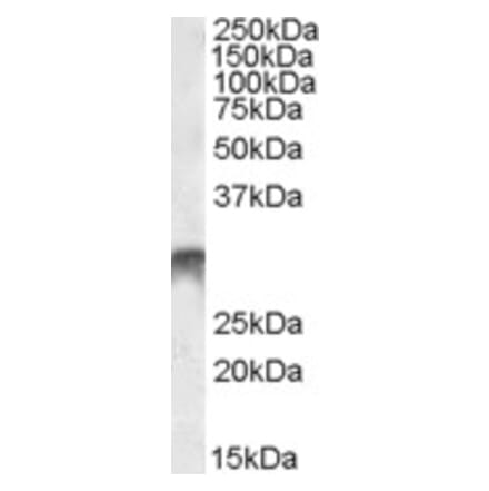 Western Blot - Anti-Dlx5 Antibody (A84658) - Antibodies.com