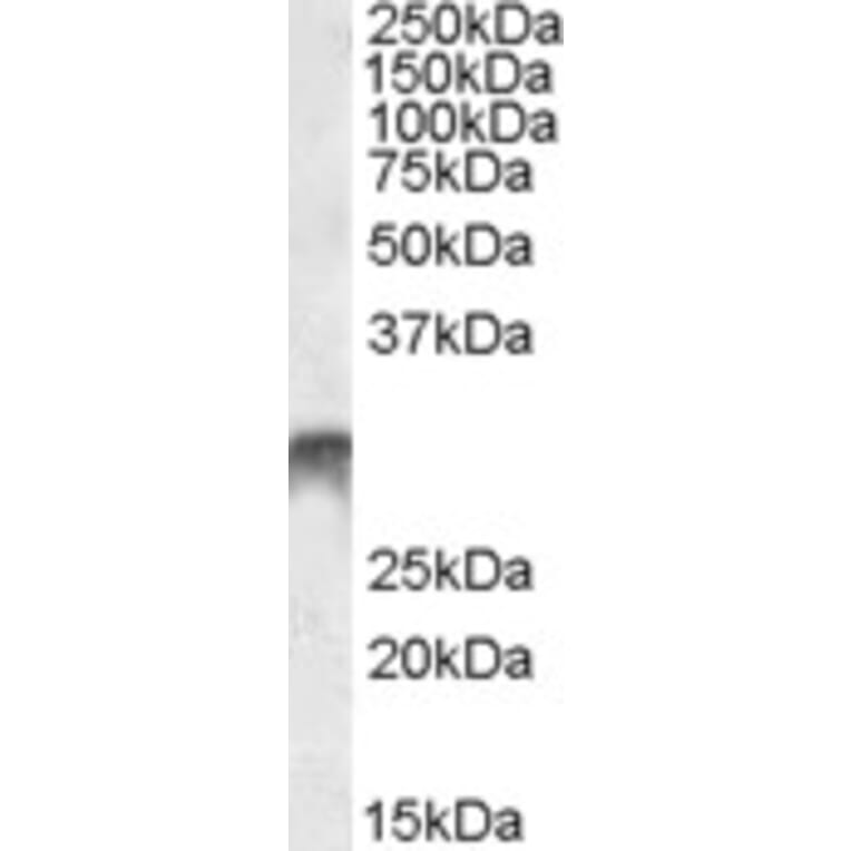 Western Blot - Anti-Dlx5 Antibody (A84658) - Antibodies.com