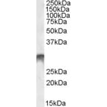 Western Blot - Anti-Dlx5 Antibody (A84658) - Antibodies.com