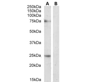 Western Blot - Anti-DLL1 Antibody (A84659) - Antibodies.com