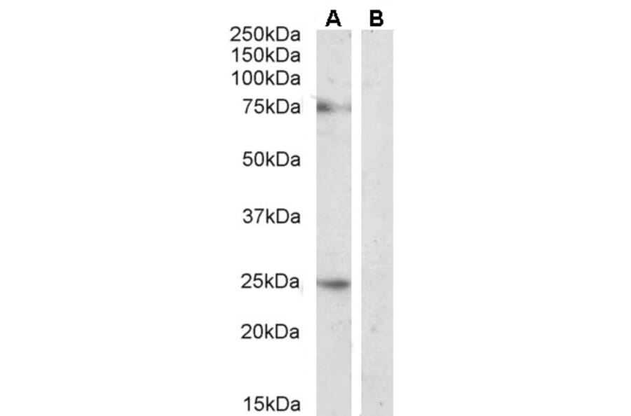 Western Blot - Anti-DLL1 Antibody (A84659) - Antibodies.com