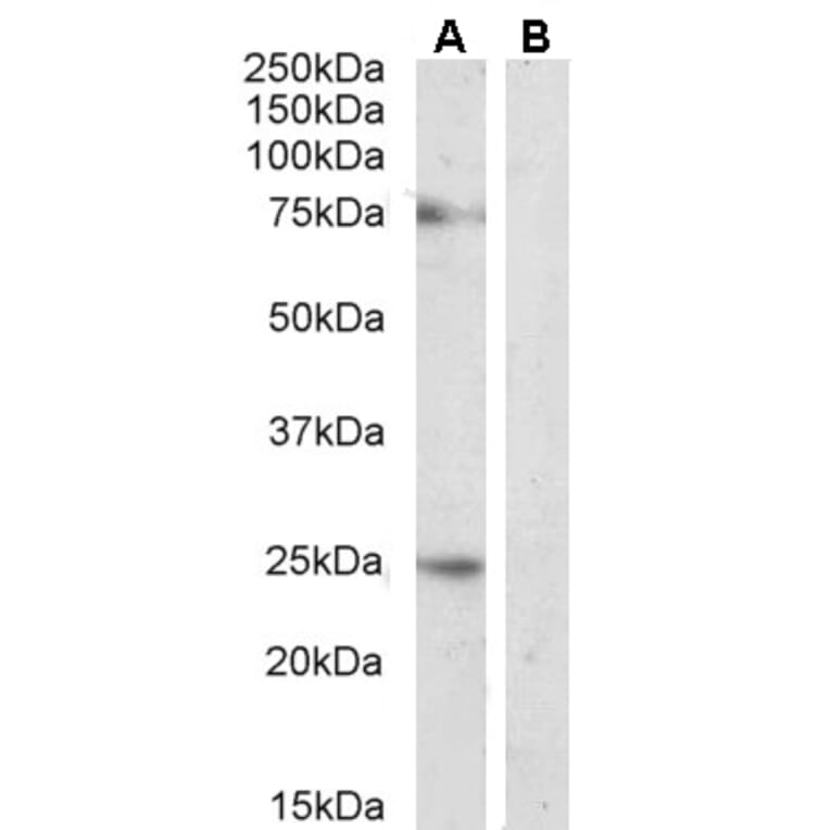 Western Blot - Anti-DLL1 Antibody (A84659) - Antibodies.com
