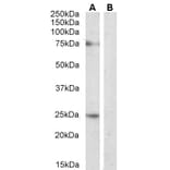 Western Blot - Anti-DLL1 Antibody (A84659) - Antibodies.com